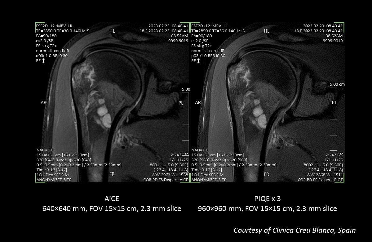 Key Clinical Imaging Tips for V9.0 PIQE Validation Sites in Europe