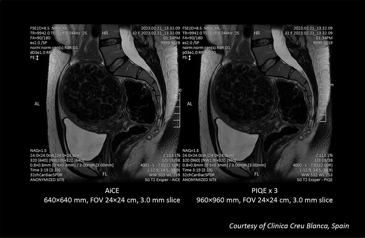 Key Clinical Imaging Tips for V9.0 PIQE Validation Sites in Europe