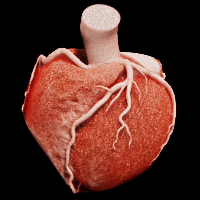 Cardiac