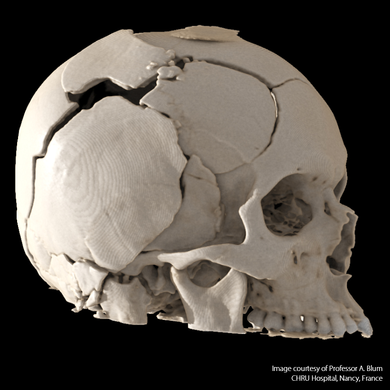 Head
